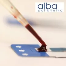 Virusi POLIKLINIKA ALBA - Poliklinika Alba - 1