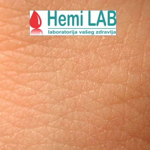 Bris kože HEMI LAB - Hemi Lab Laboratorija - 3