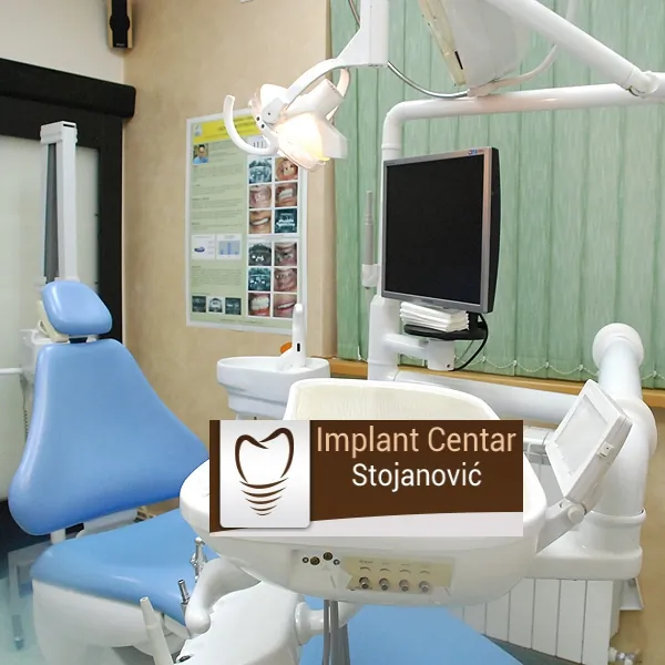 Hiruško lečenje parodontopatije (Widmanova terapija) IMPLANT CETAR STOJANOVIĆ - Implant Centar Stojanović - 2