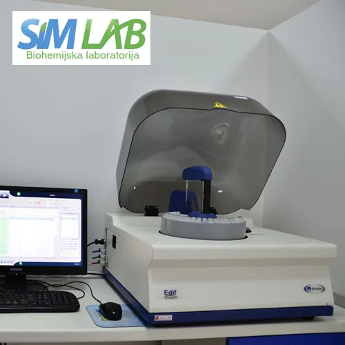 Progesteron SIM LAB - Laboratorija za medicinsku biohemiju SIM LAB - 2