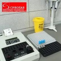 ELEKTROLITI - Srbolab laboratorija za medicinsku biohemiju - 1