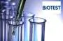 Tumor marker CEA BIOTEST - Biohemijska laboratorija Biotest - 1