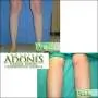 Dermoplastika podkolenica ADONIS - Bolnica za estetsku hirurgiju Adonis - 1