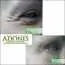 Korekcija očnih kapaka ADONIS - Bolnica za estetsku hirurgiju Adonis - 1