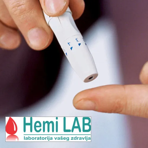 Glukoza HEMI LAB - Hemi Lab Laboratorija - 3