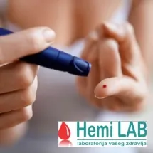 Glukoza HEMI LAB - Hemi Lab Laboratorija - 1