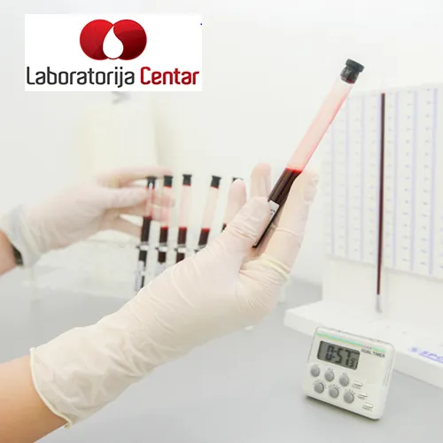 Analiza sperme LABORATORIJA CENTAR - Laboratorija Centar - 1