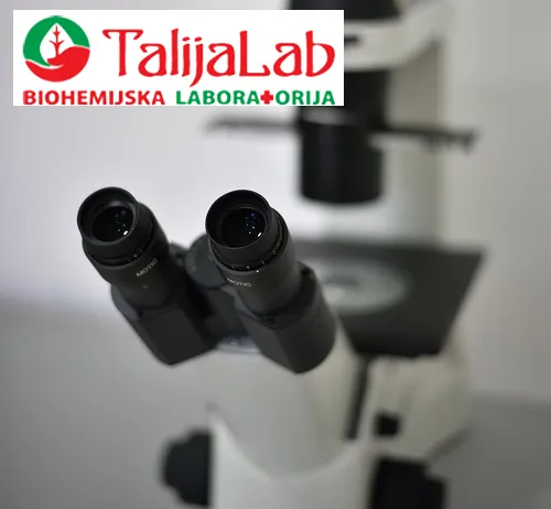 Spermogram TALIJA LAB - Biohemijska laboratorija Talija Lab - 4