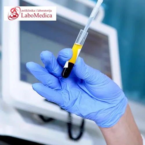 Spermogram LABOMEDICA - Poliklinika i laboratorija LABOMEDICA - 2