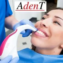 Uklanjanje zubnog kamenca ADENT - Stomatološka ordinacija AdenT - 1