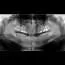 ORTOPAN  Emailom + film + cd - Centar za snimanje zuba Diamond 3D - 5