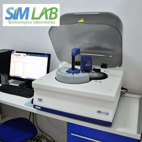 Spermogram SIM LAB - Laboratorija za medicinsku biohemiju SIM LAB - 2