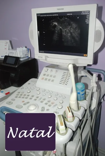 Ginekološki ultrazvuk ORDINACIJA NATAL - Ginekološka ordinacija NATAL - 3