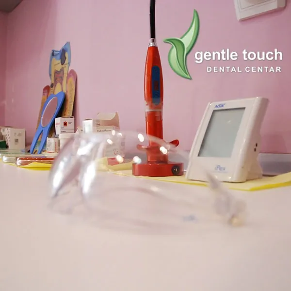 Uklanjanje zubnog kamenca GENTLE TOUCH DENTAL CENTAR - Stomatološka ordinacija Gentle touch Dental centar - 1