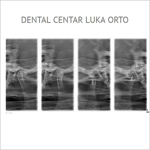 TM zglobovi  DENTAL CENTAR LUKA ORTO - Dental centar Luka Orto - 3