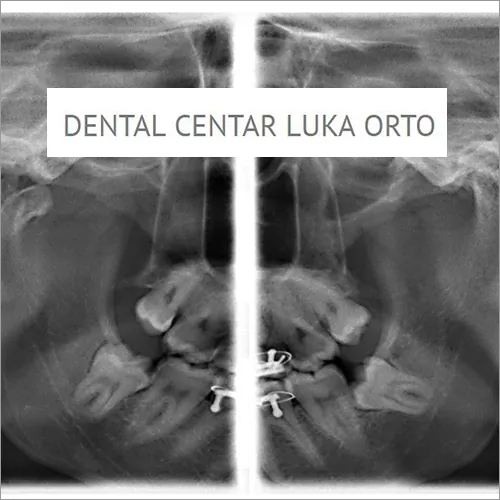 TM zglobovi  DENTAL CENTAR LUKA ORTO - Dental centar Luka Orto - 2