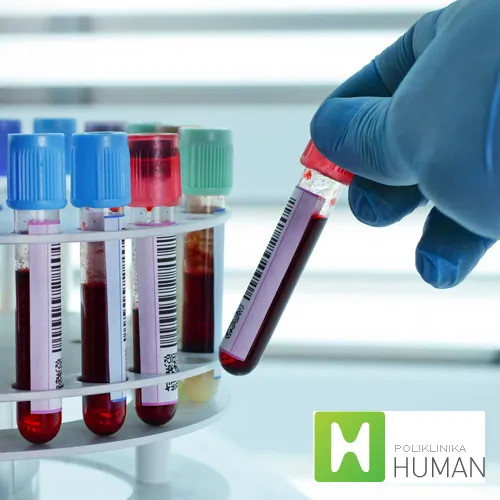 Virusološka serologija HUMAN LABORATORIJE - Human laboratorije - 1