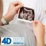 Ultrazvučni ginekološki pregled ORDINACIJA 4D - Ginekološko akušerska ordinacija 4d - 1