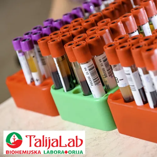 Hormoni TALIJA LAB - Biohemijska laboratorija Talija Lab - 2