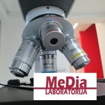 Tumor markeri BIOHEMIJSKA LABORATORIJA MEDIA - Biohemijska laboratorija MeDia Smederevo - 1