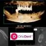 3D POLJE 8,5X5 ORTO DENT DIGITAL 3D - ORTOPAN CENTAR - Orto Dent Digital 3D - Ortopan centar - 2