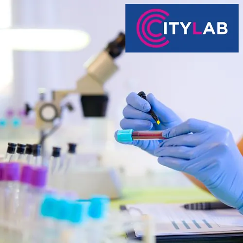 Double i Triple test LABORATORIJA CITYLAB - Biohemijska laboratorija CityLab - 2