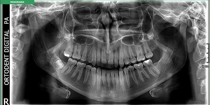 Orto Dent Digital 3D - Ortopan centar - 29