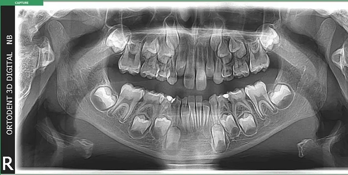 Orto Dent Digital 3D - Ortopan centar - 30