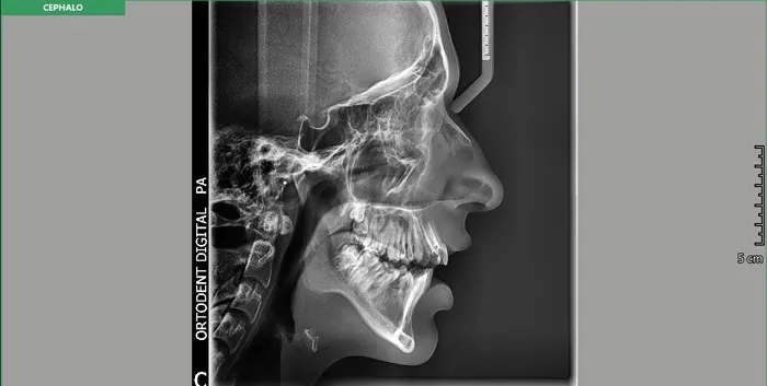 Orto Dent Digital 3D - Ortopan centar - 2D SNIMANJE ORTO DENT DIGITAL 3D - ORTOPAN CENTAR - 1