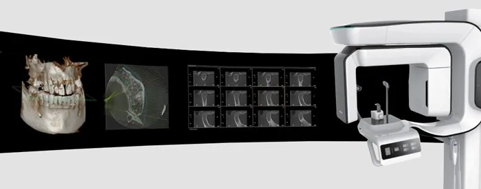 Orto Dent Digital 3D - Ortopan centar - 35