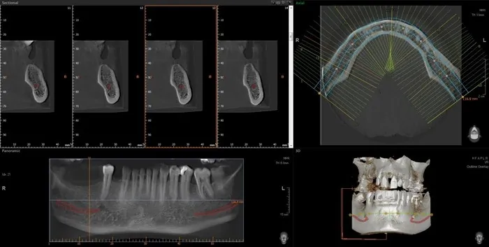 Orto Dent Digital 3D - Ortopan centar - 37