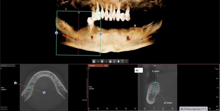 Orto Dent Digital 3D - Ortopan centar - 38
