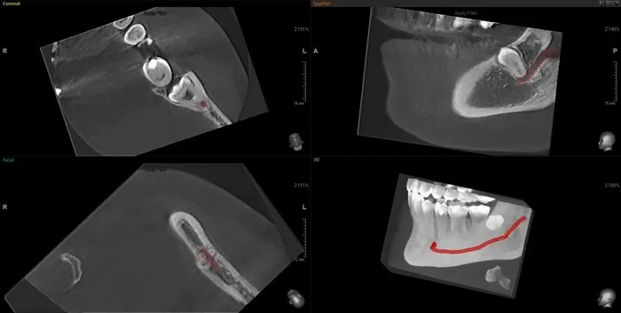 Orto Dent Digital 3D - Ortopan centar - 39