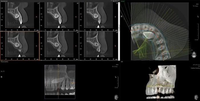 Orto Dent Digital 3D - Ortopan centar - 3D SNIMANJE ORTO DENT DIGITAL 3D - ORTOPAN CENTAR - 1