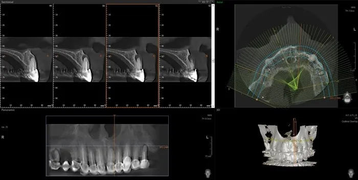 Orto Dent Digital 3D - Ortopan centar - 3D SNIMANJE ORTO DENT DIGITAL 3D - ORTOPAN CENTAR - 1