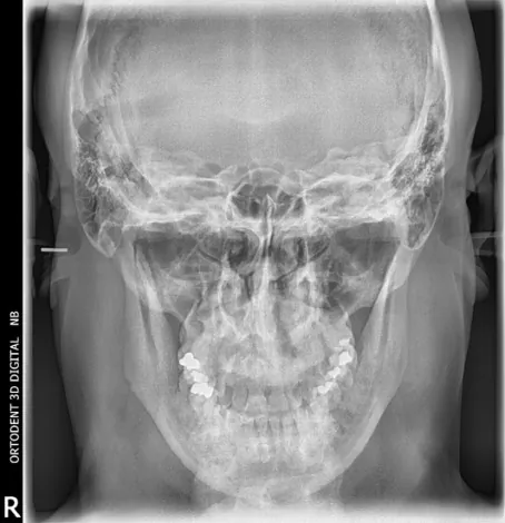 Orto Dent Digital 3D - Ortopan centar - 44