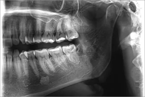 Dental Diagnostic Centar - 2D SNIMANJE - 1