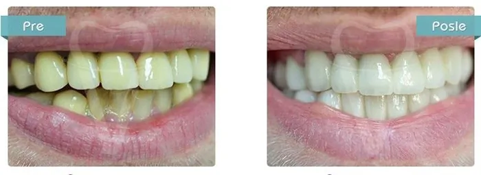 Stomatološka ordinacija Dental Vision - 39