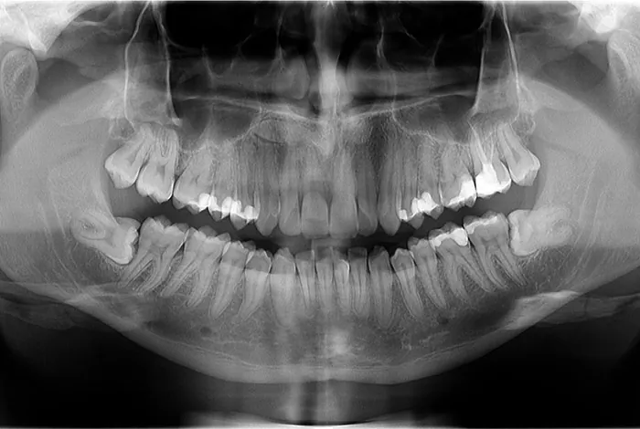 Centar za snimanje zuba Diamond 3D - 2D SNIMANJE ZUBA - 1