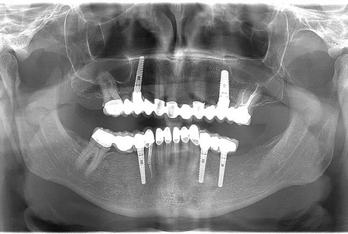 Dental centar Luka Orto - 11