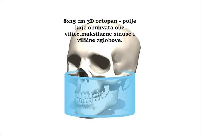 Dental centar Luka Orto - 3D SNIMANJE U STOMATOLOGIJI  DENTAL CENTAR LUKA ORTO - 1