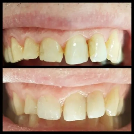 Stomatološka ordinacija Dentina - KONZERVATIVNA STOMATOLOGIJA DENTINA - 1