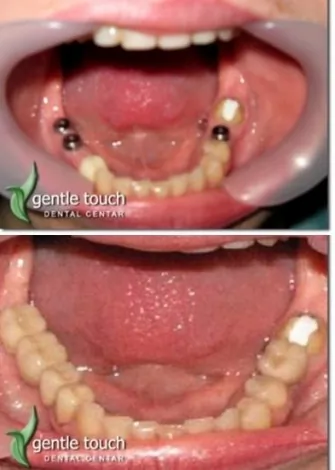 Stomatološka ordinacija Gentle touch Dental centar - 53