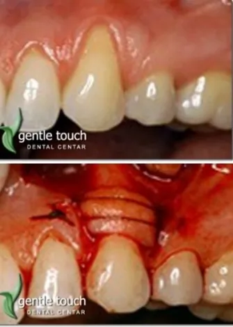 Stomatološka ordinacija Gentle touch Dental centar - 61