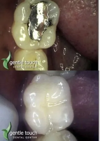 Stomatološka ordinacija Gentle touch Dental centar - 62