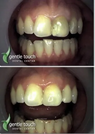 Stomatološka ordinacija Gentle touch Dental centar - 63