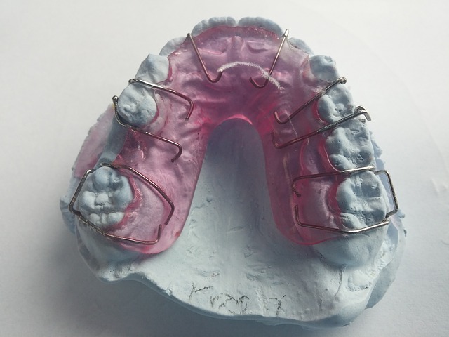 Blog ilustracija: Estetska stomatologija u stomatološkim ordinacijama