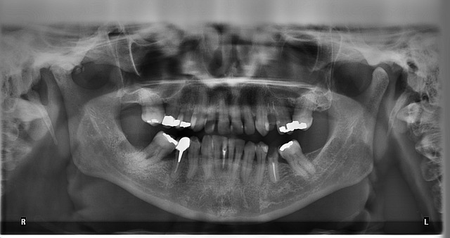 Blog ilustracija: Vrste snimanja zuba u stomatološkim rendgen centrima
