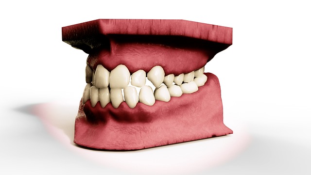 Blog ilustracija: Šta su fiksne proteze ili fiksni ortodontski aparati