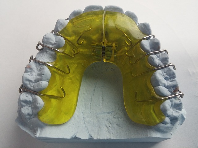 Blog ilustracija: Dečije zubne proteze - mobilni ortodontski aparati